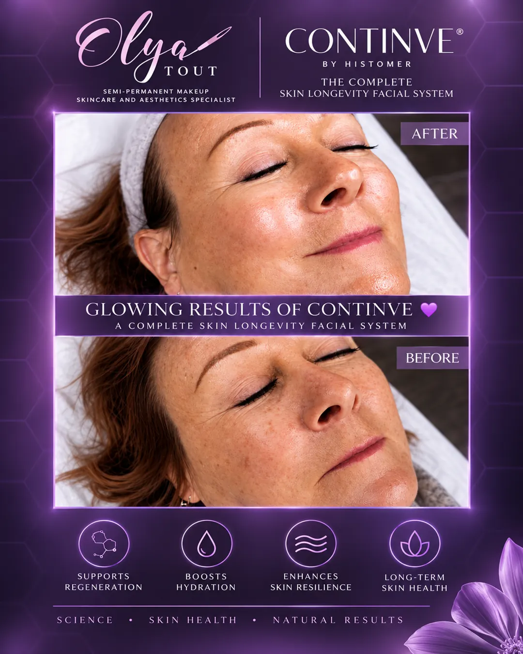 ContinVe facial before-and-after results