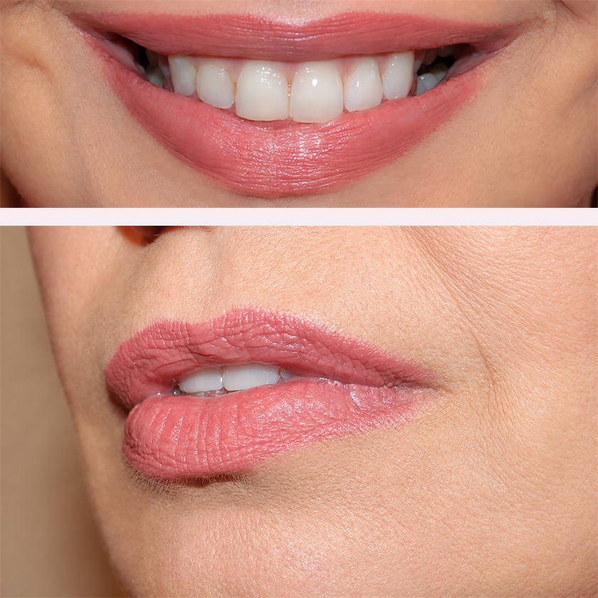 Lip blush After photos
